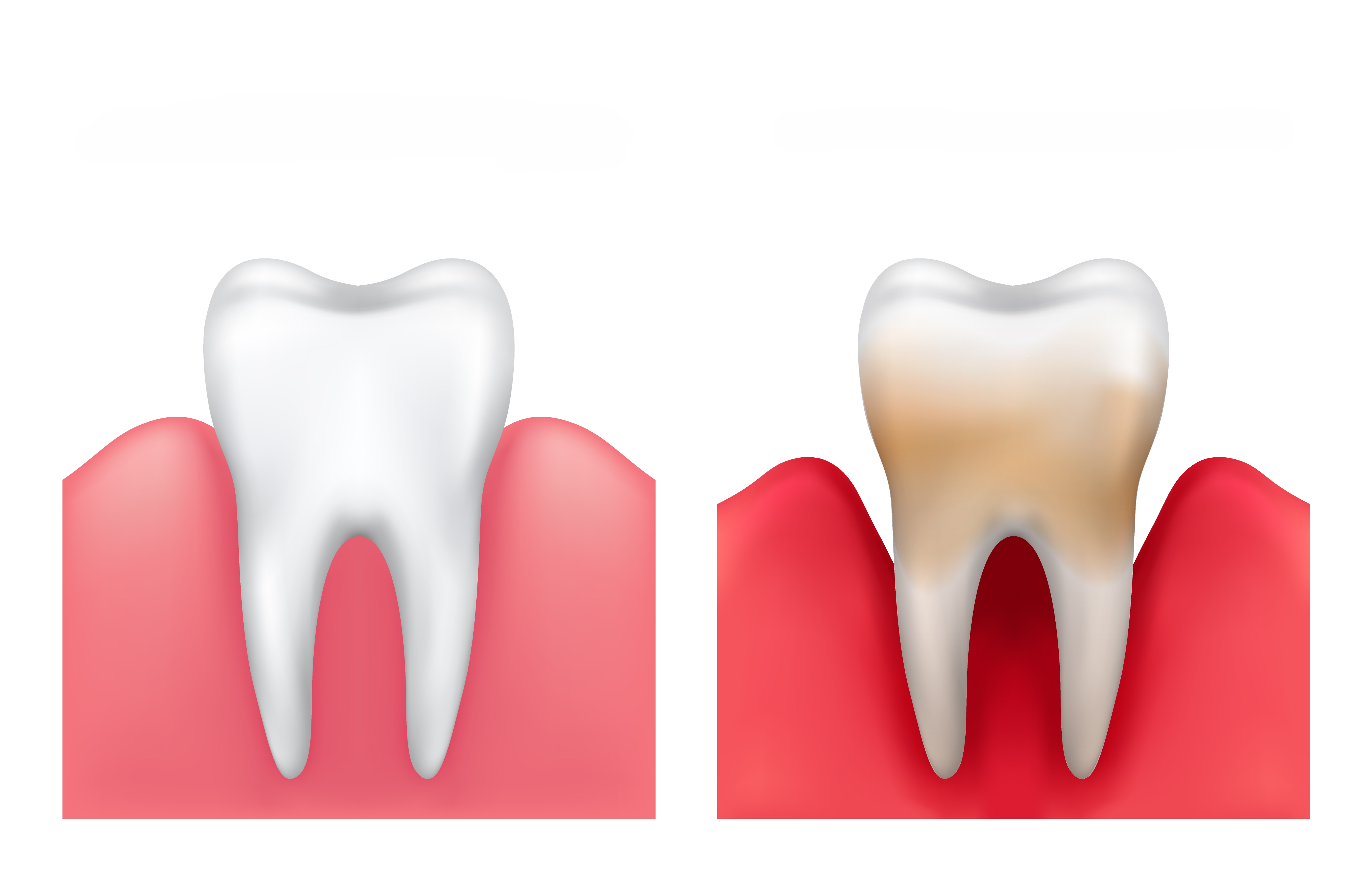 Teeth